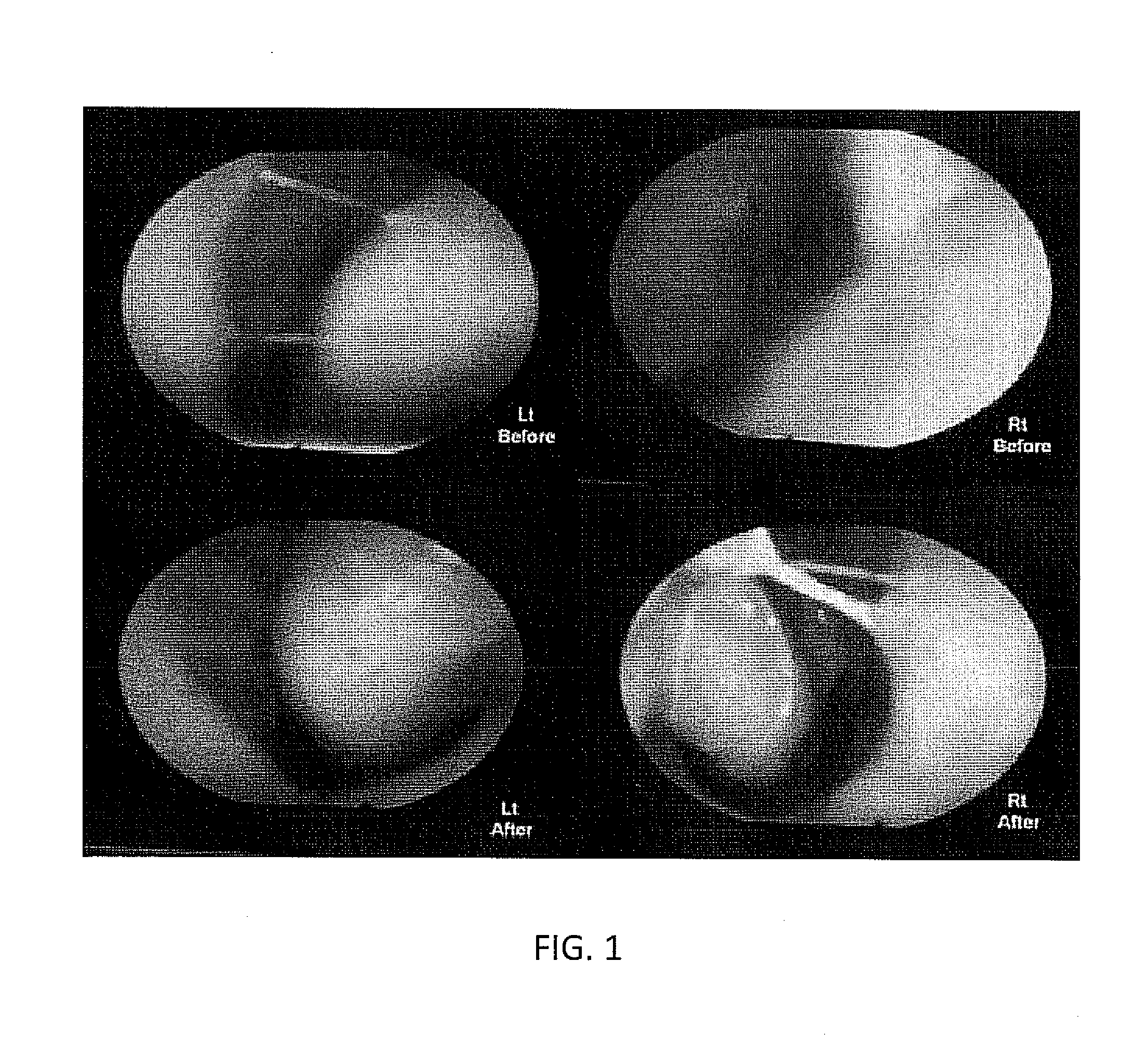 Non-occluding nasal moisturizer and methods of use