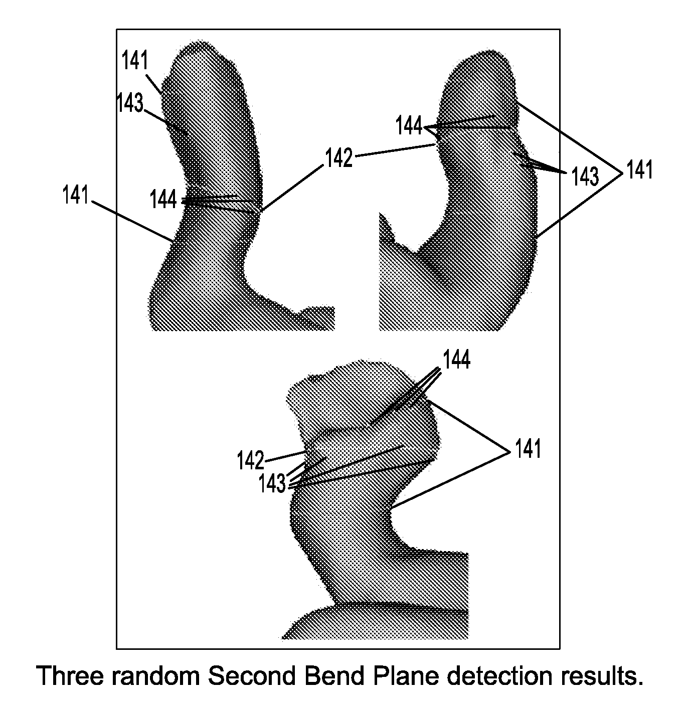 System and method for automatic detection of anatomical features on 3D ear impressions