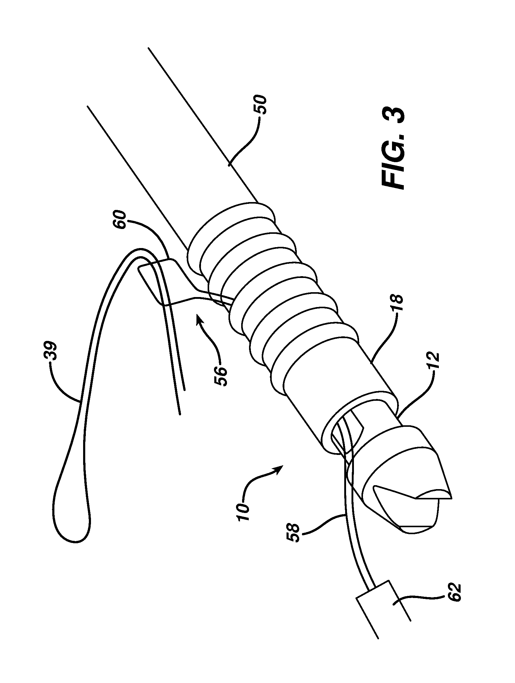 Knotless suture anchor