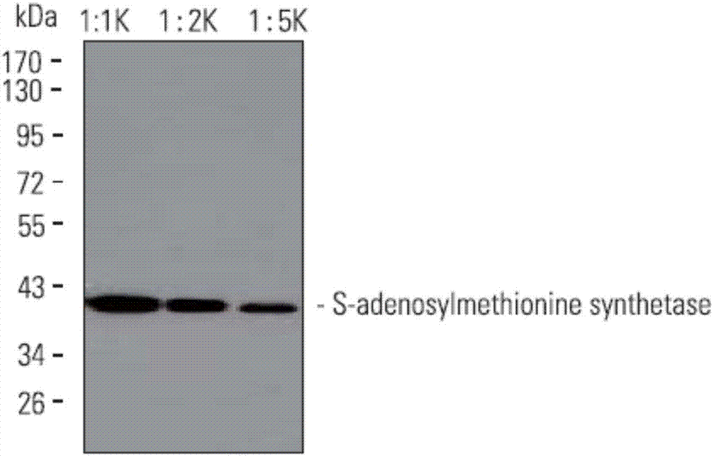 Monoclonal antibody of S-adenosylmethionine synthetase and application thereof