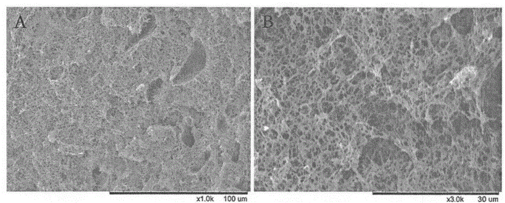 A tissue engineering nanofiber osteochondral repair scaffold and its preparation method