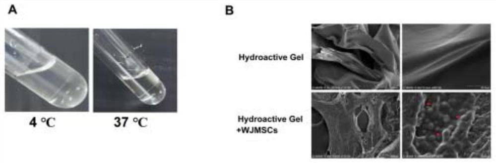 Mesenchymal stem cell preparation for treating diabetic cutaneous ulcers and preparation method of mesenchymal stem cell preparation