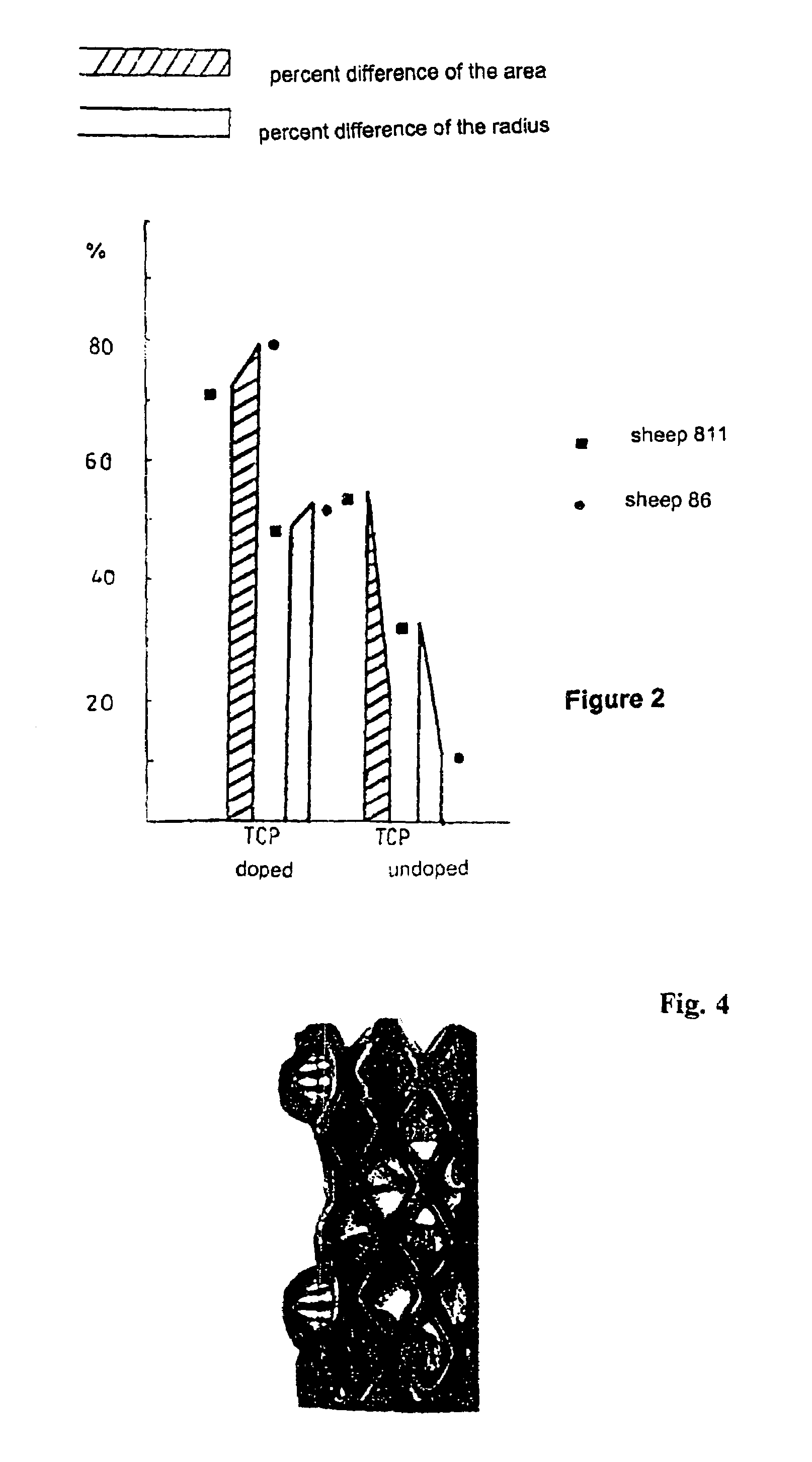 Agent for the manufacture of biological parts including an active ingredient complex and carrying materials suitable for the active ingredient complex