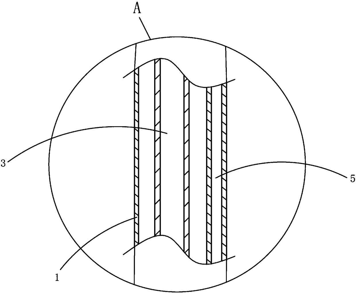 Pigtail-shaped peritoneal double-sleeve drainage catheter