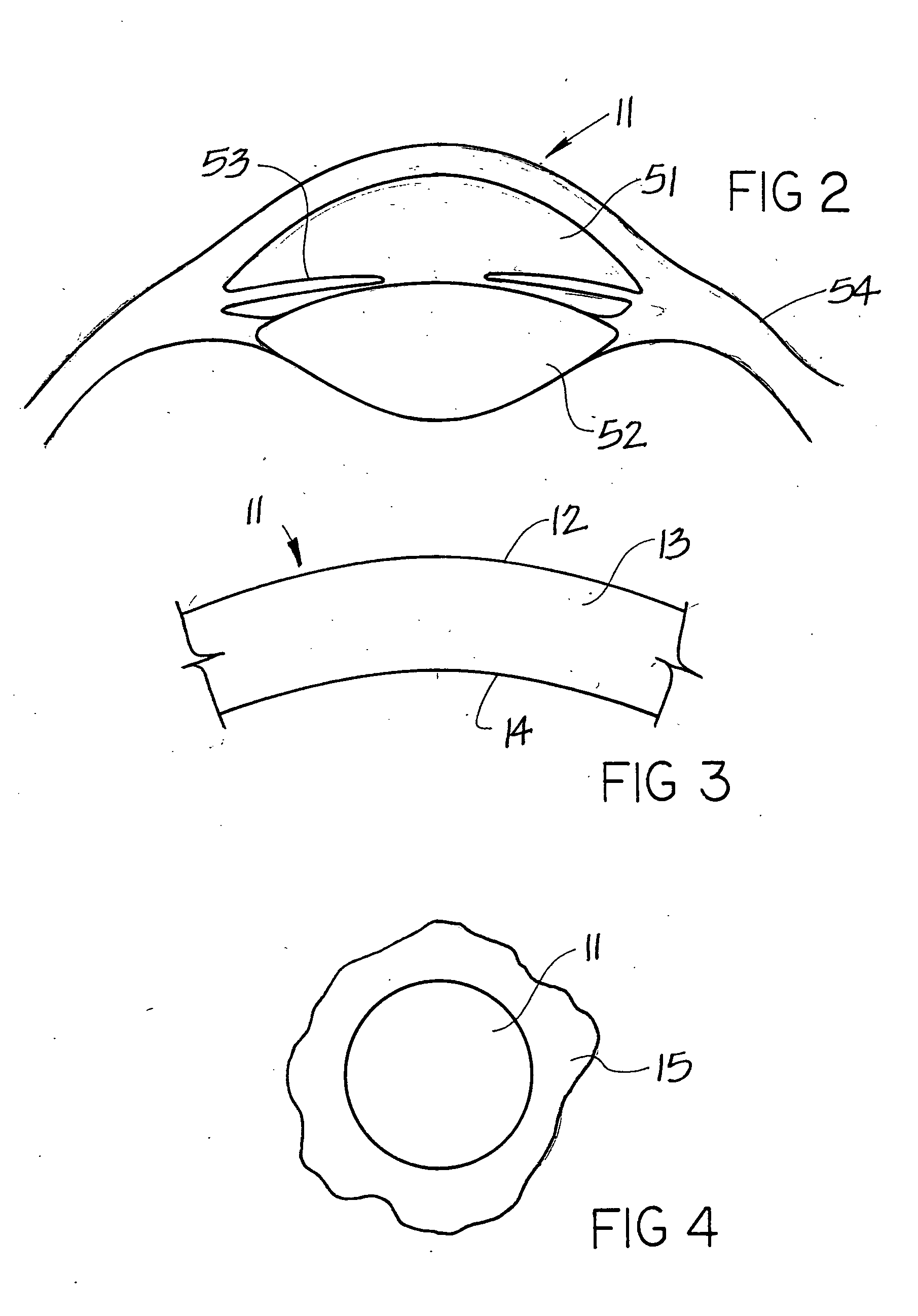 Method and apparatus of cornea examination