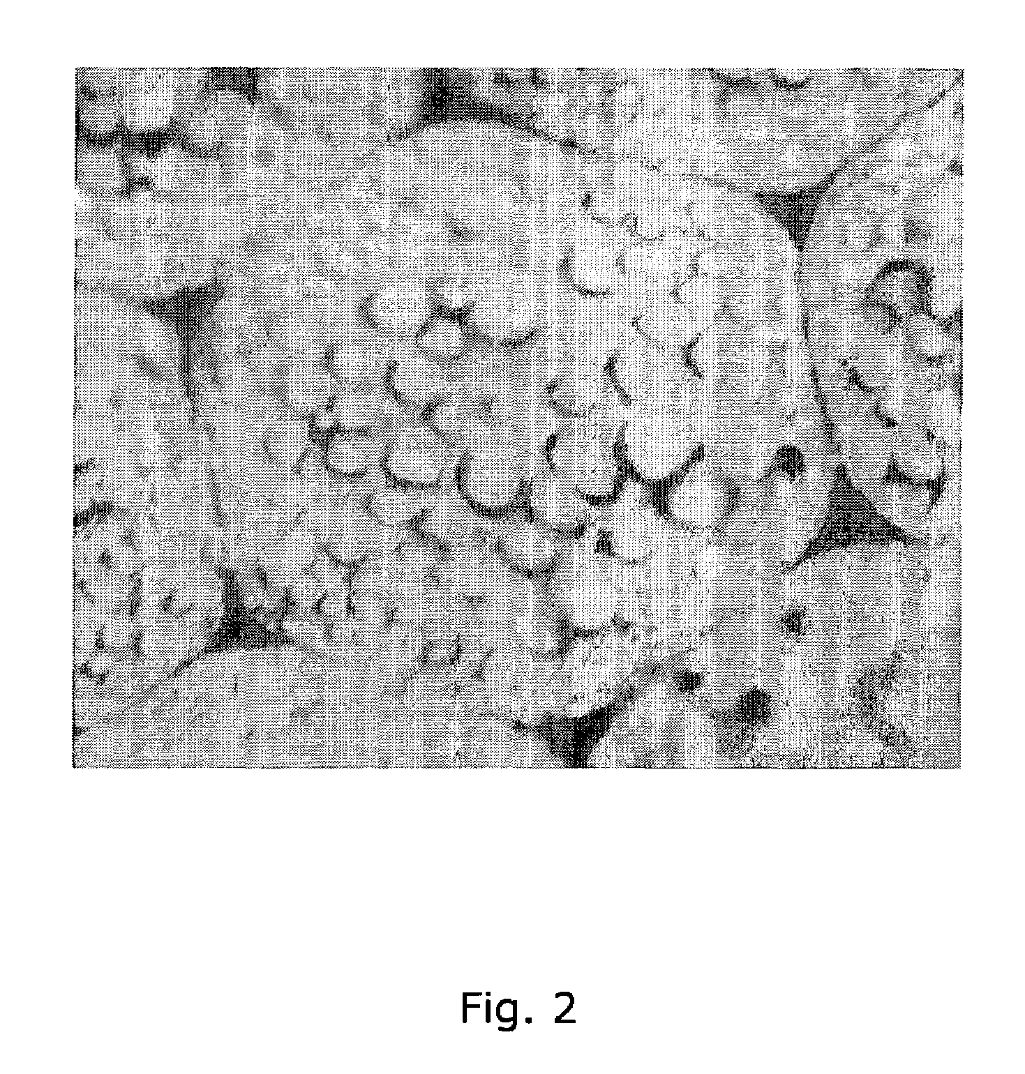 Method for producing ultrafine fiber and artificial leather