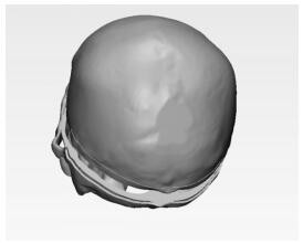 A kind of cranial brain simulation model and preparation method thereof