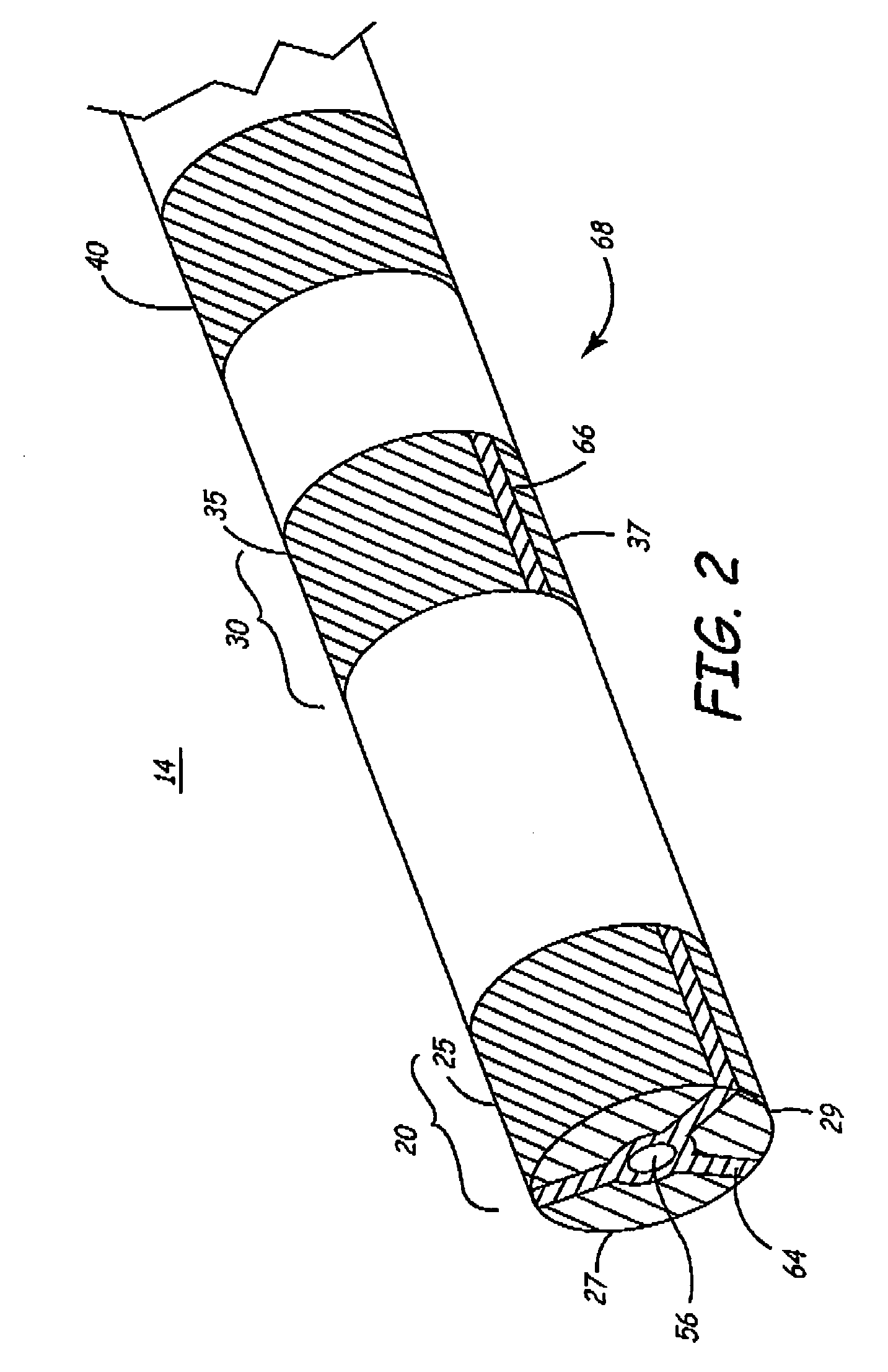 Method and apparatus for selecting an optimal electrode configuration of a medical electrical lead having a multiple electrode array
