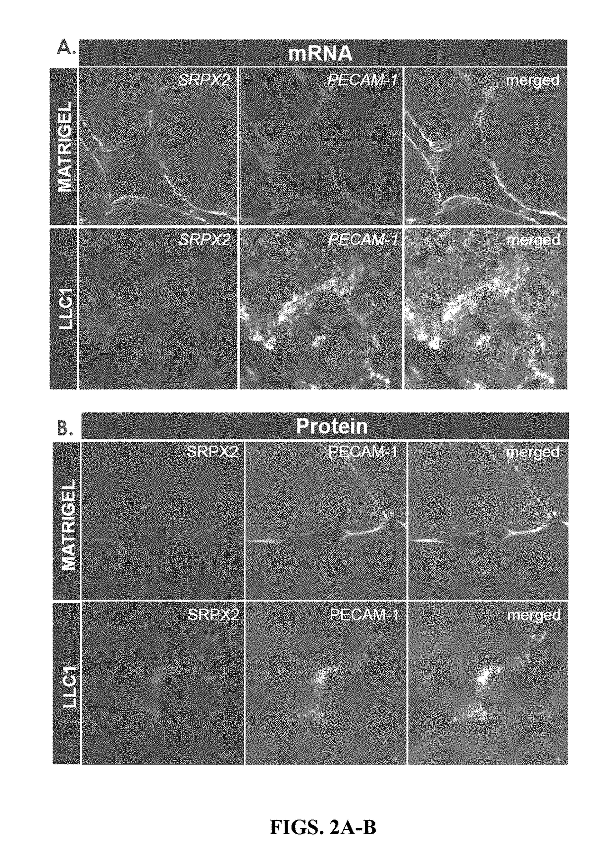 Modulation of srpx2-mediated angiogenesis