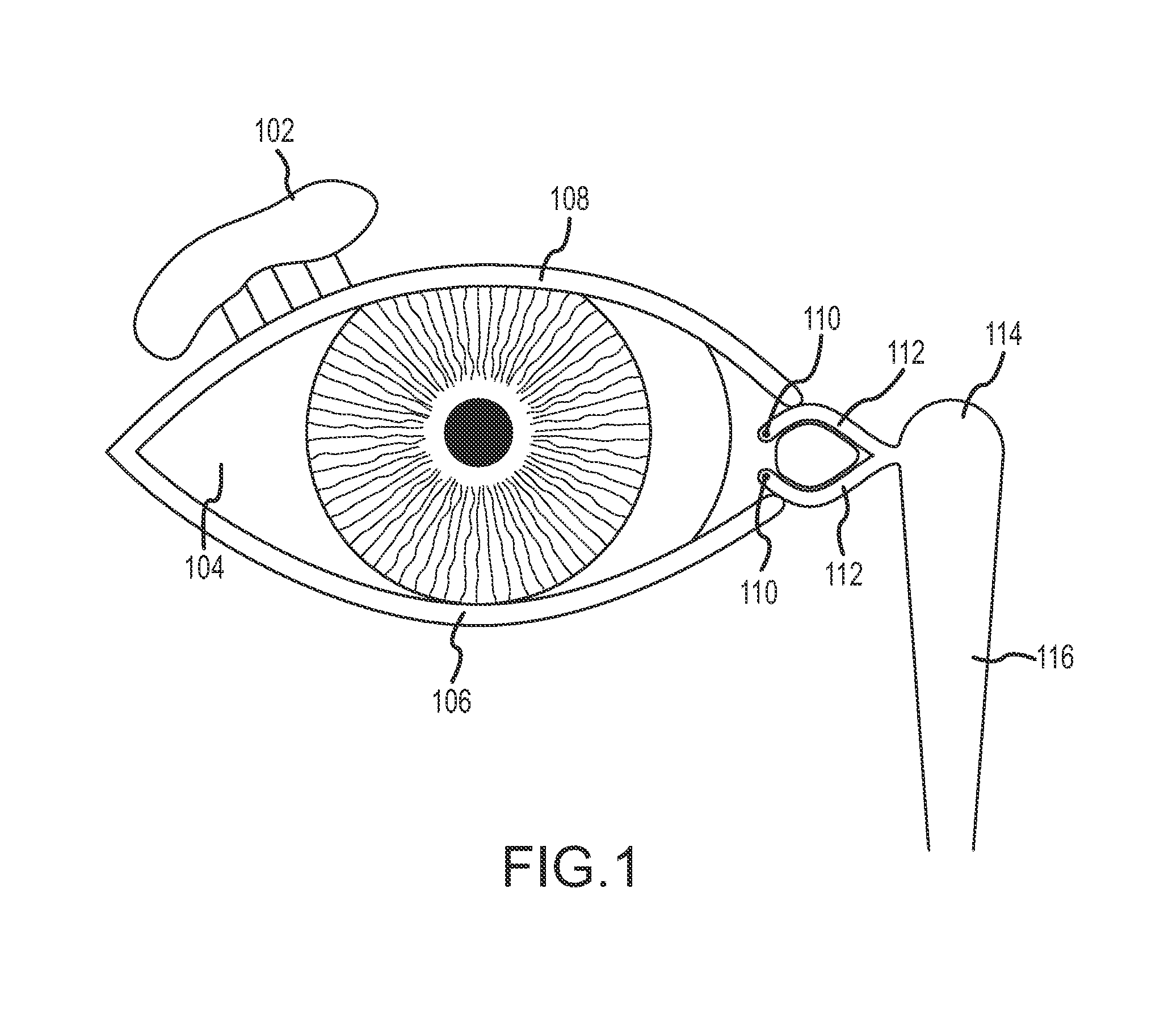 Implant device, tool, and methods relating to treatment of paranasal sinuses