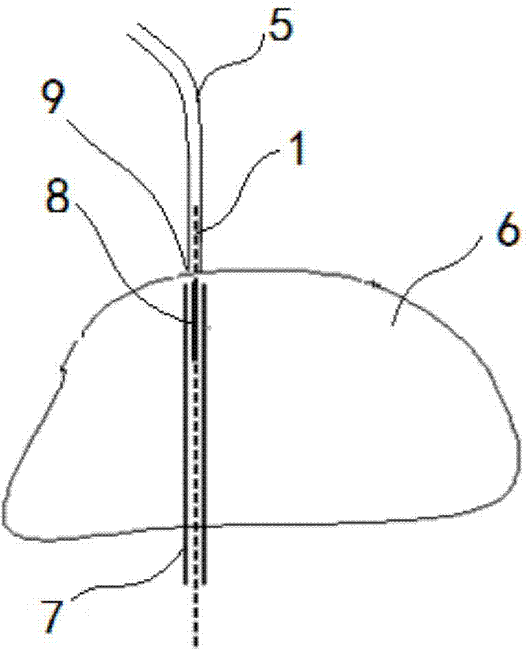 Multipurpose ureteroscope sacculus guidewire and using method thereof