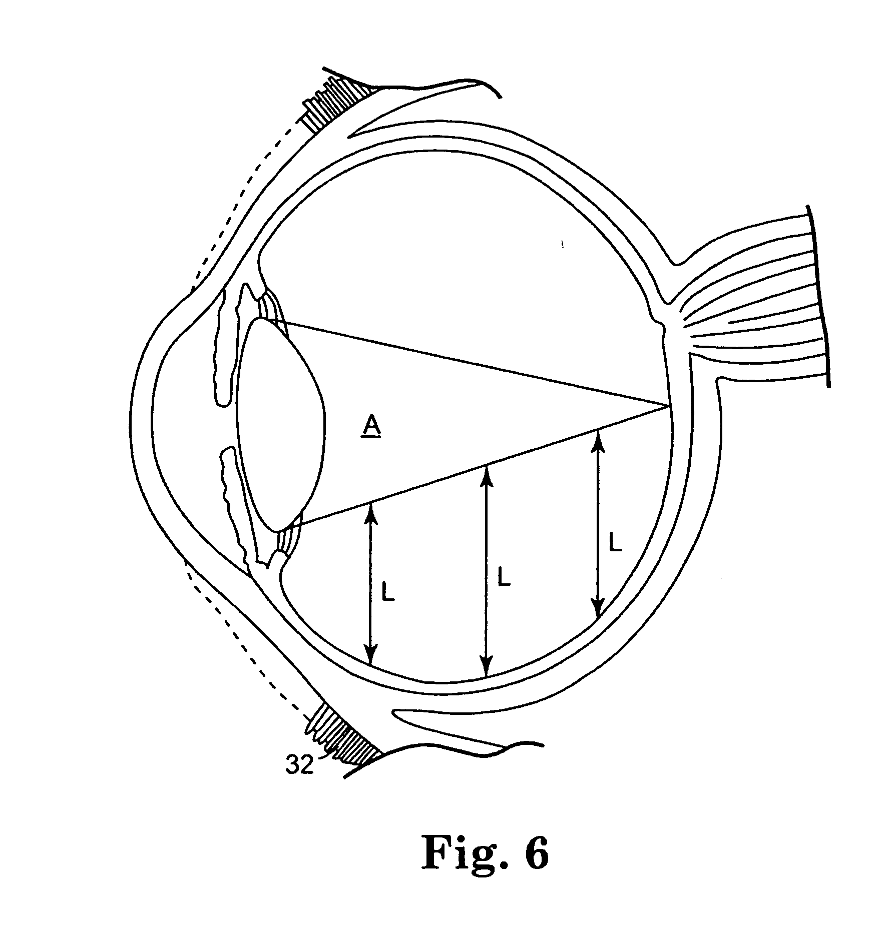 Controlled release bioactive agent delivery device