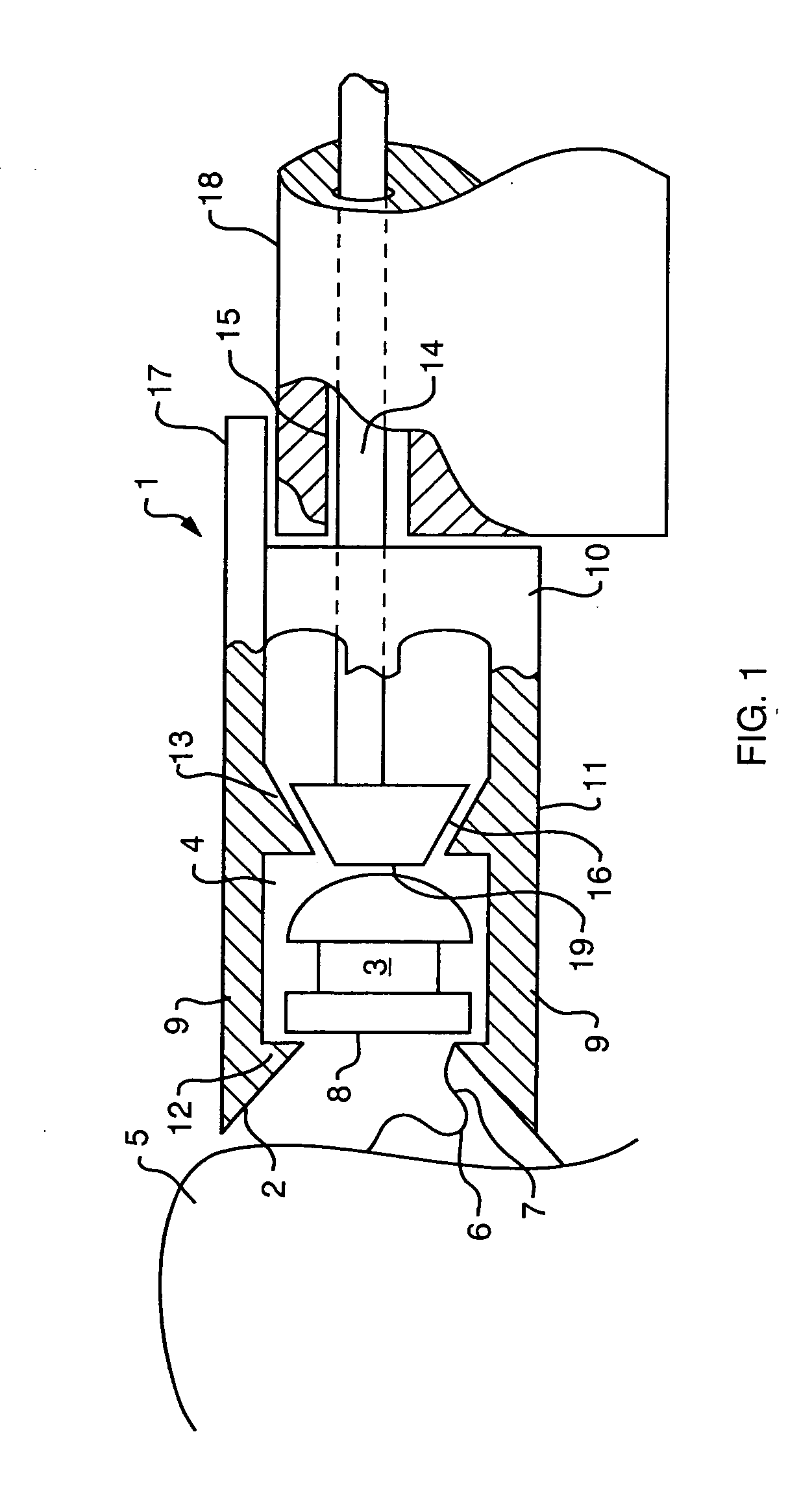 Suture clips, delivery devices and methods