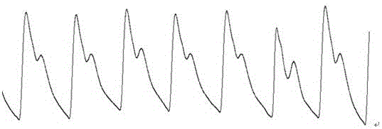 Method for evaluating cardiac function by using pulse waves