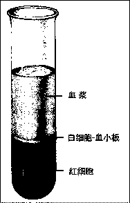 Method of identifying blood stratification