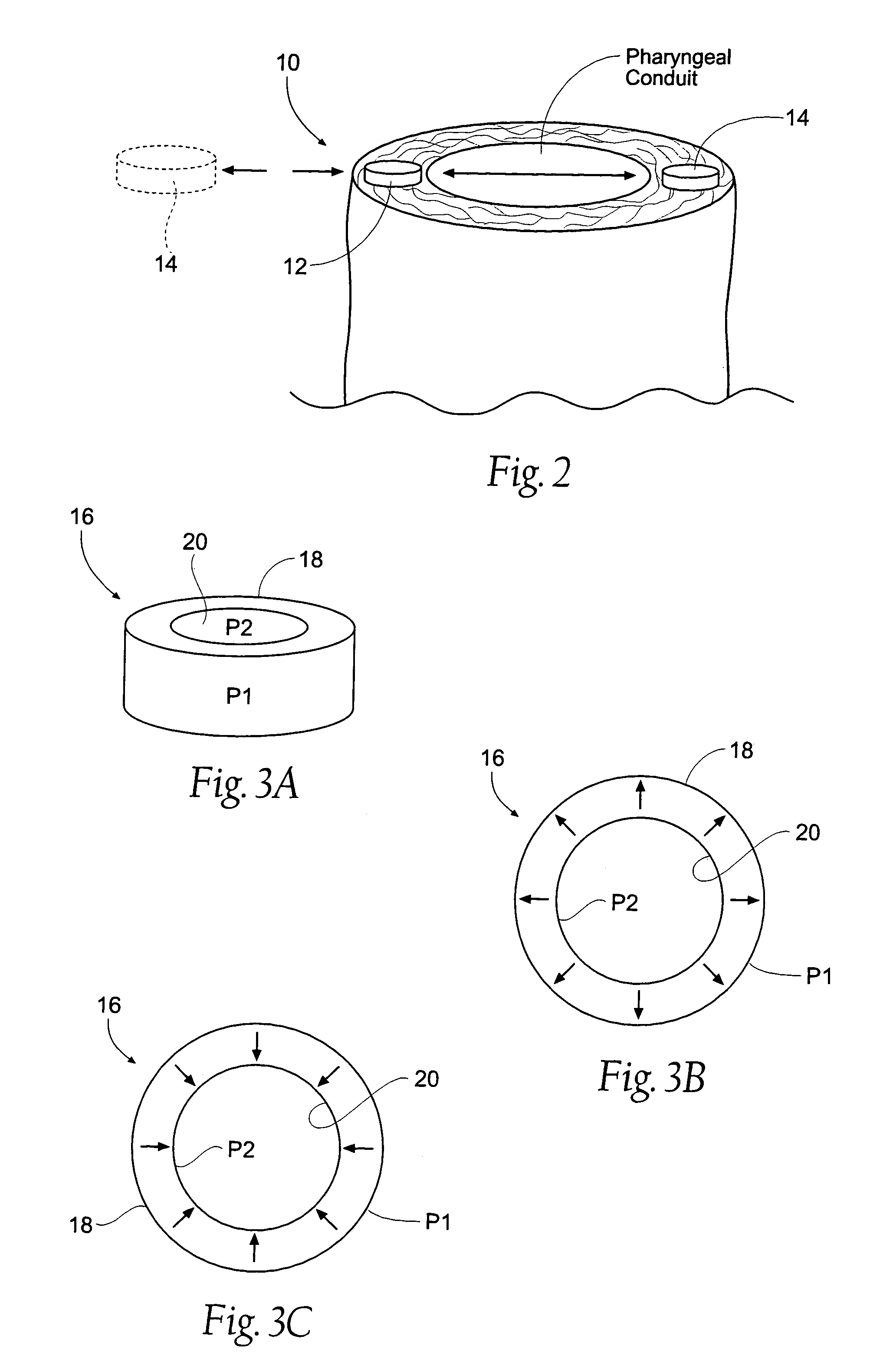 Magnetic force devices, systems, and methods for resisting tissue collapse within the pharyngeal conduit
