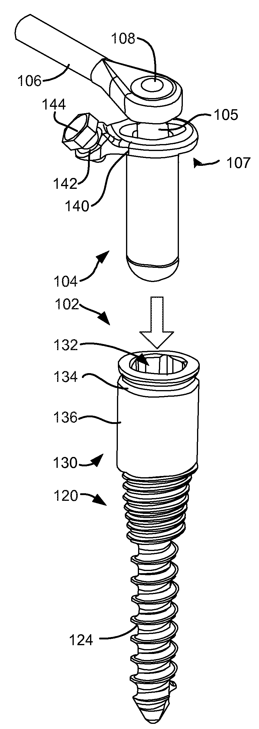 Low profile spinal prosthesis incorporating a cannulated bone anchor having a deflectable post and a compound spinal rod