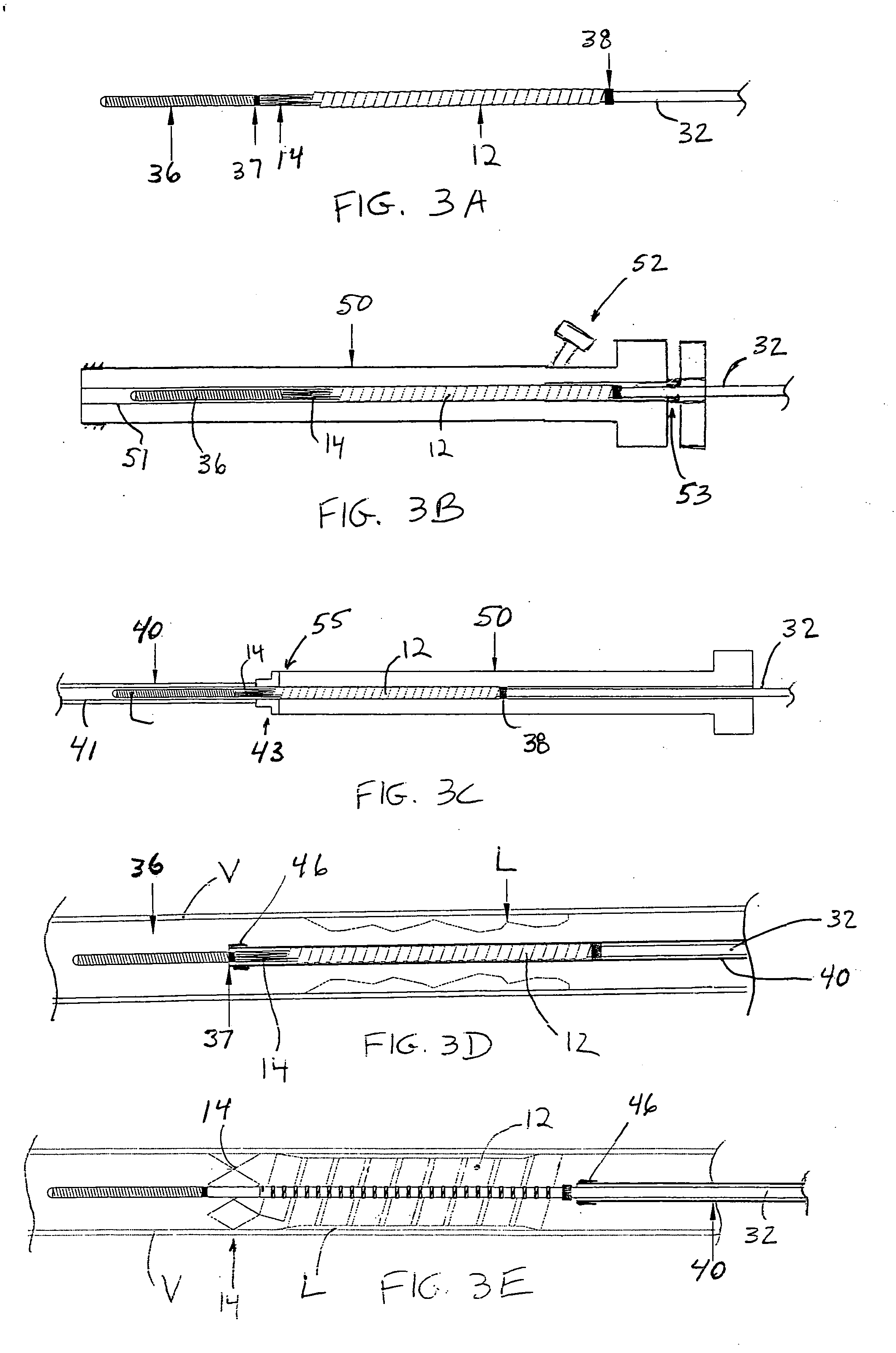 Delivery system for vascular prostheses and methods of use
