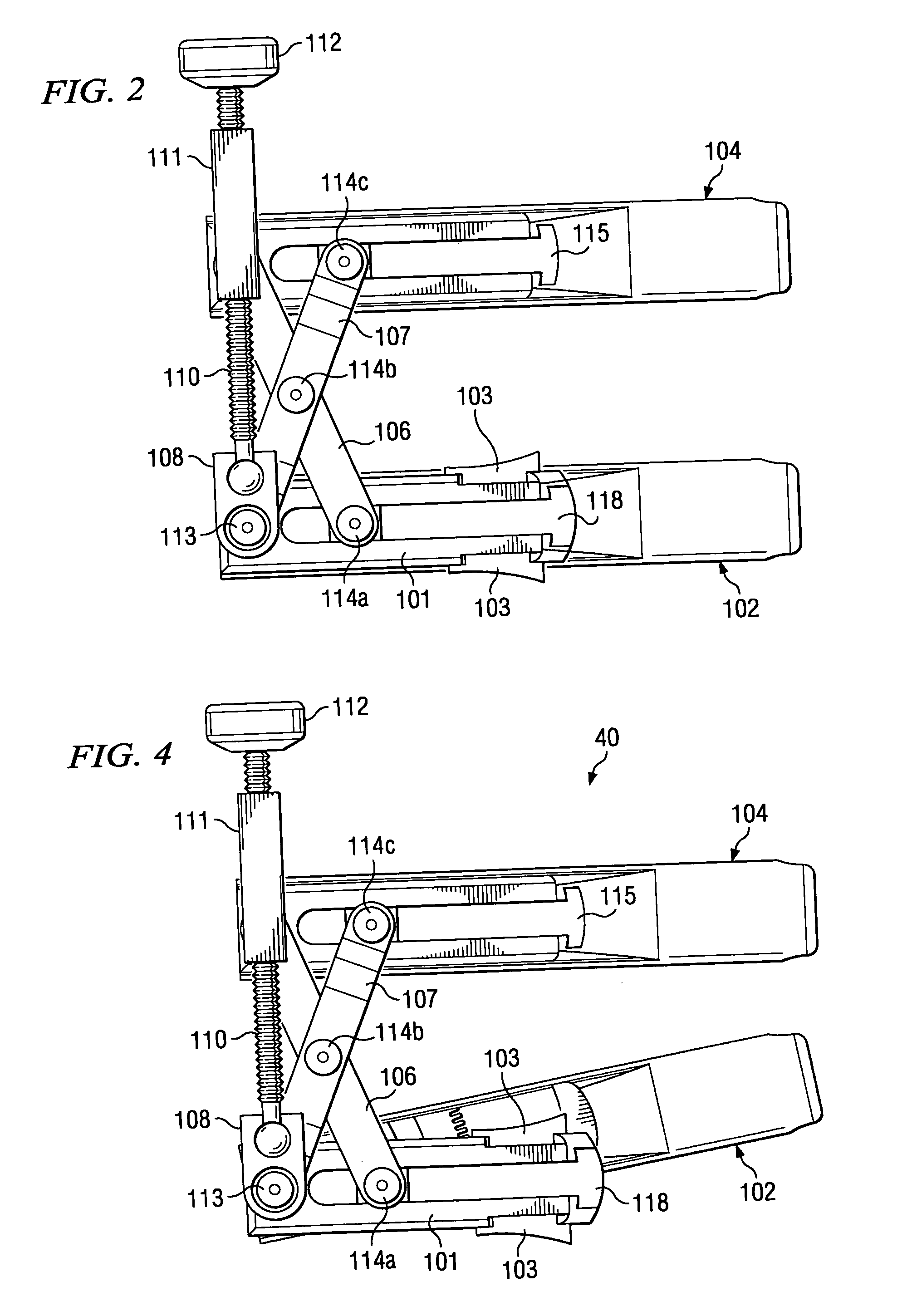 System and method for displacement of bony structures
