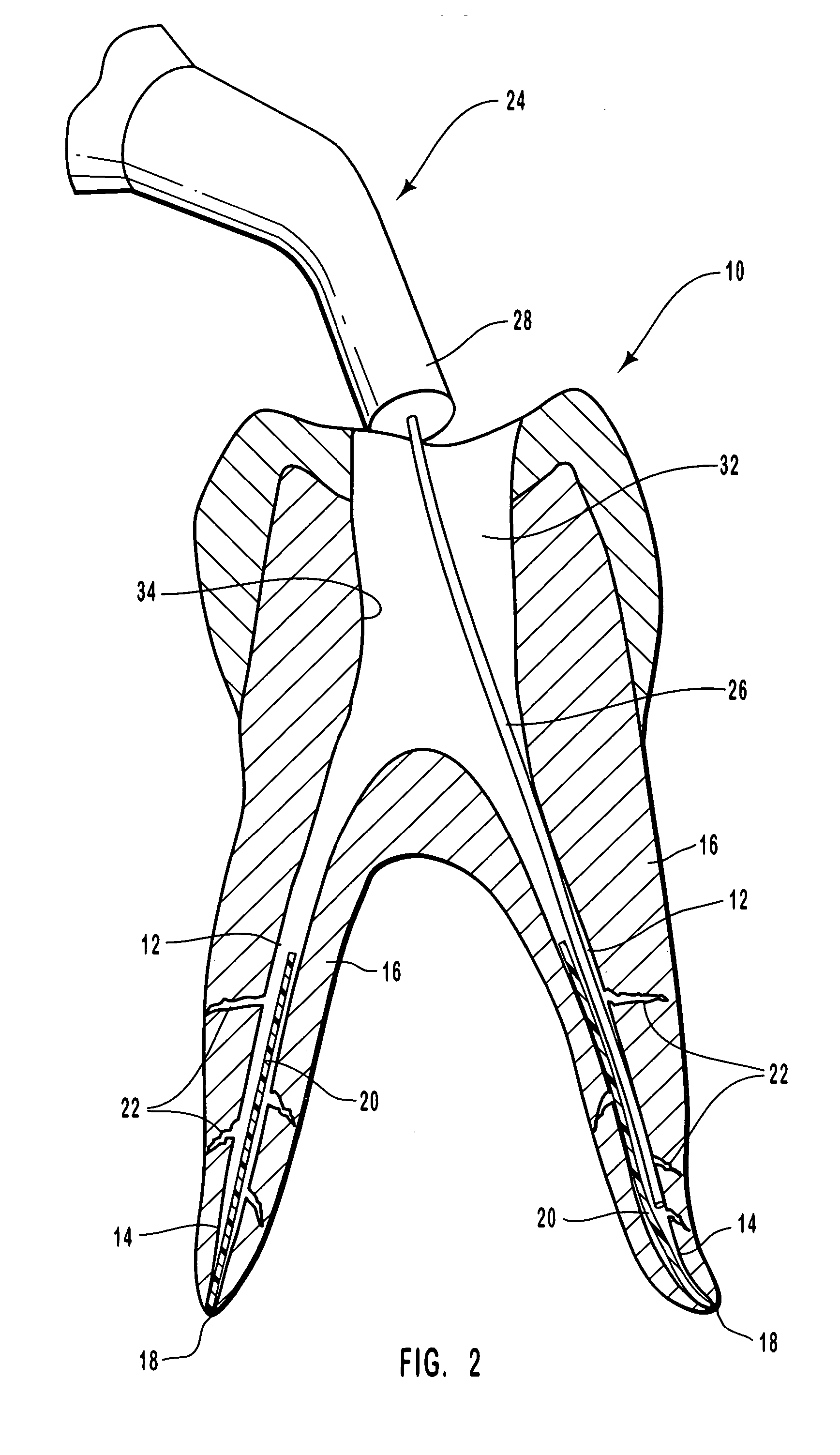 Hydrophilic endodontic sealing compositions and methods for using such compositions