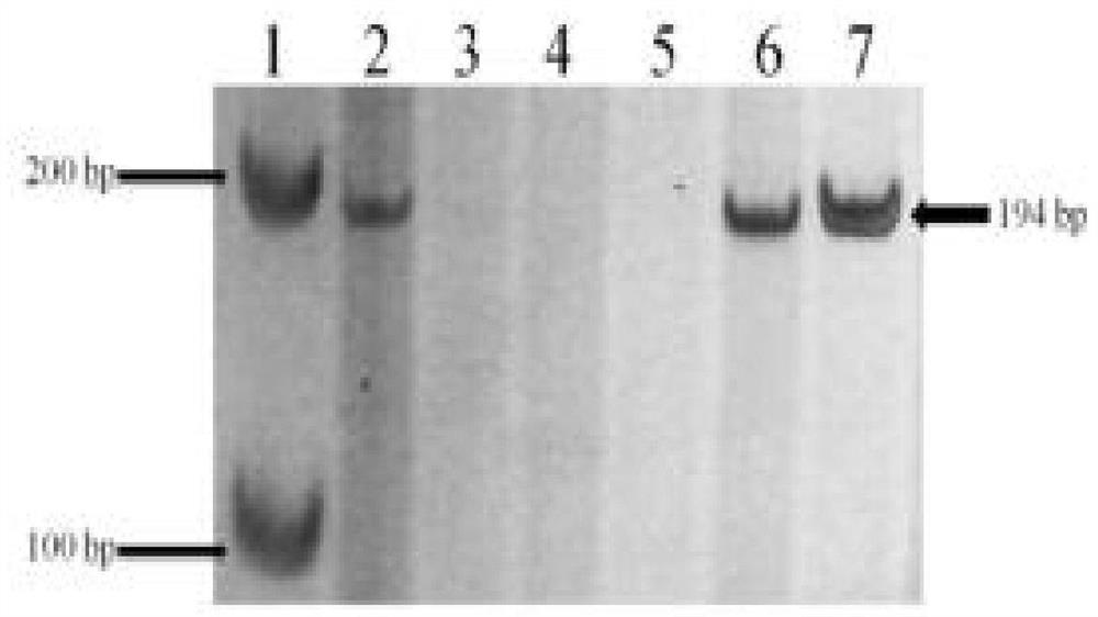 Method for rapidly identifying thinopyrum intermedium 4St chromosome