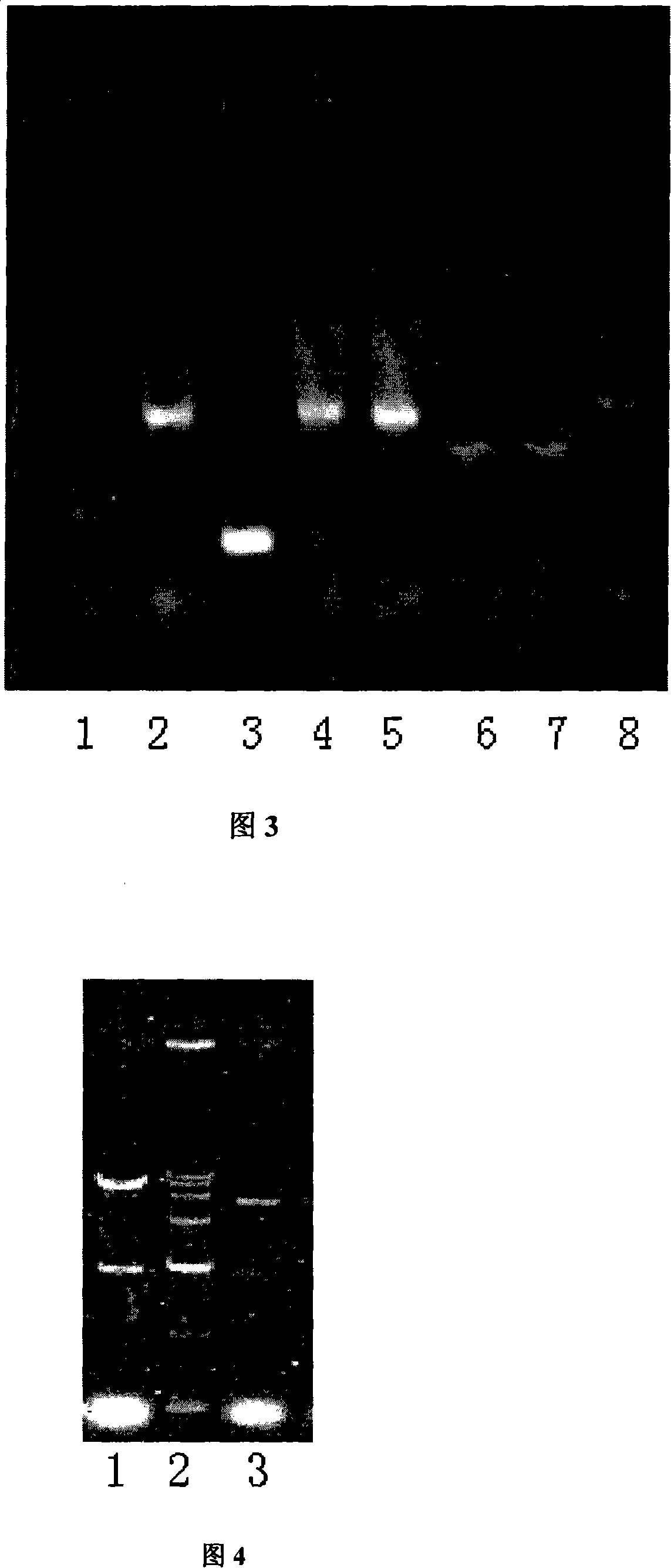 Method of preparing recombination human source catalase and application thereof