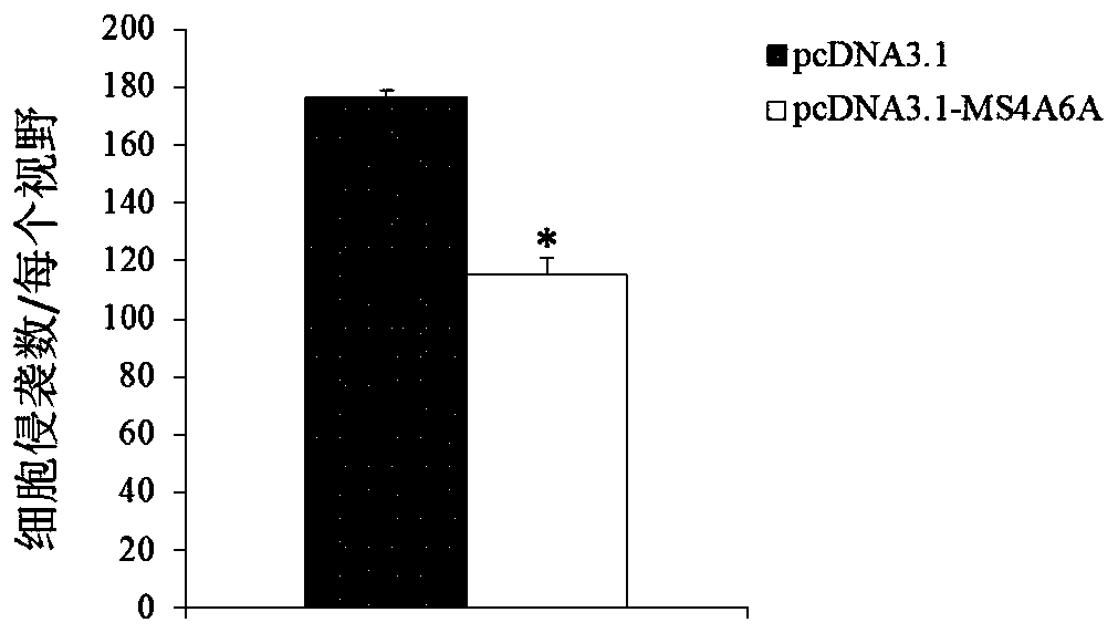 Use of ms4a6a as a marker for diagnosis and treatment of multiple myeloma