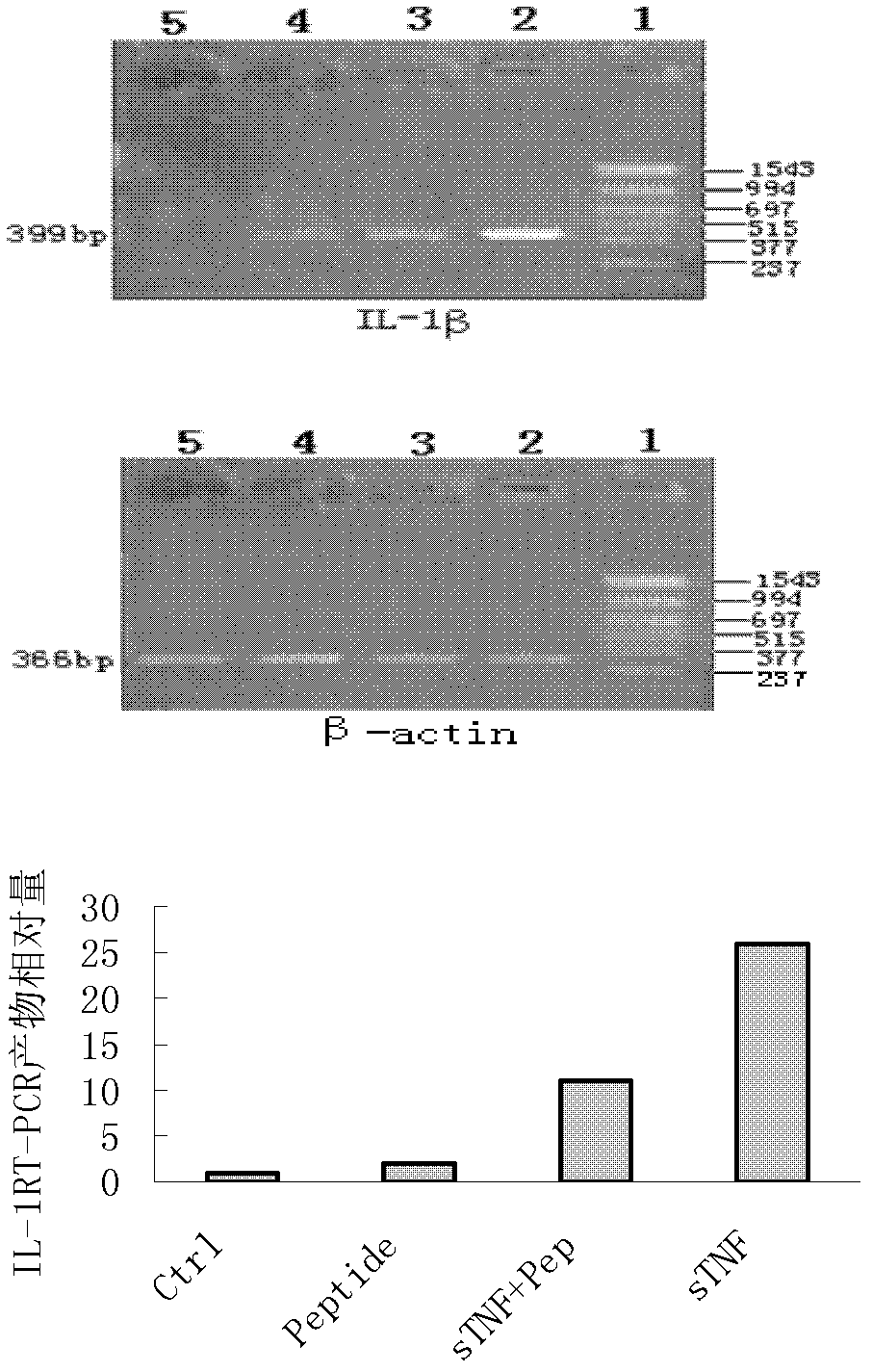 Tumor necrosis factor (TNF) binding peptide and TNFR1 blocking peptide, and application thereof in treatment of ulcerative colitis