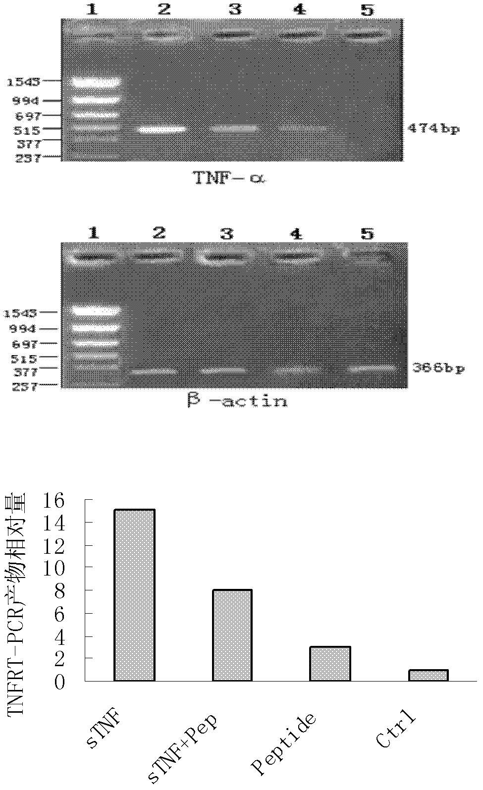 Tumor necrosis factor (TNF) binding peptide and TNFR1 blocking peptide, and application thereof in treatment of ulcerative colitis