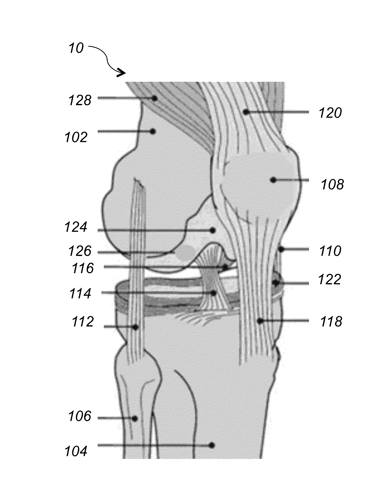 System and method for ligament insertion in knee joint surgeries using adaptive migration of ligament insertion geometry