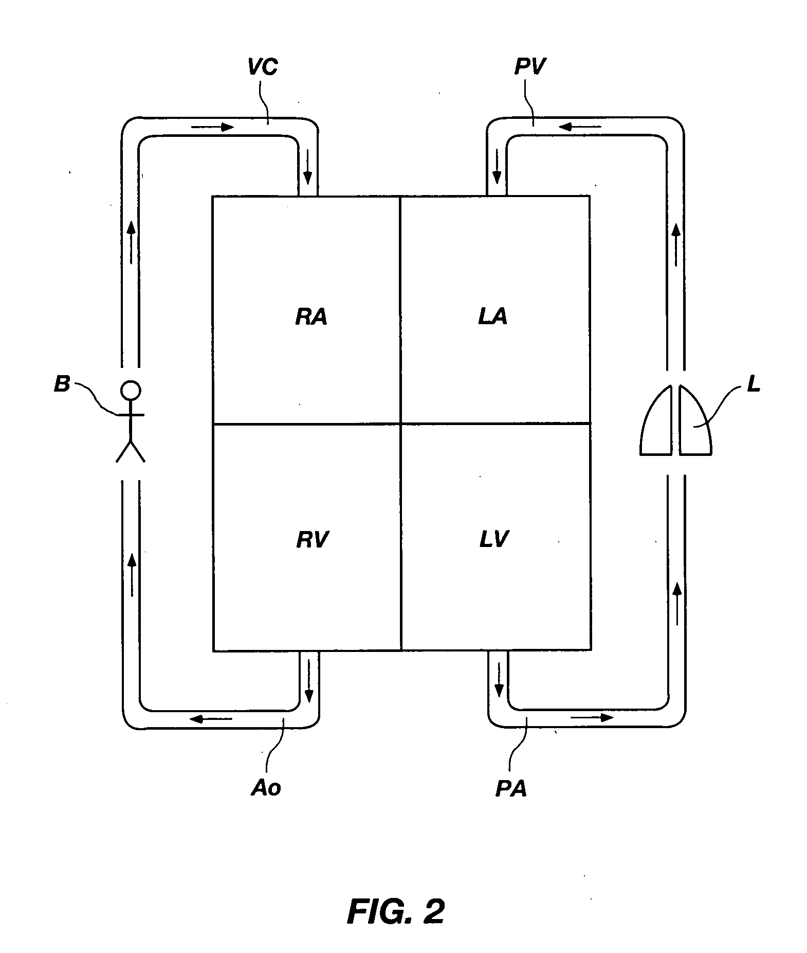 Pulmonary artery banding device