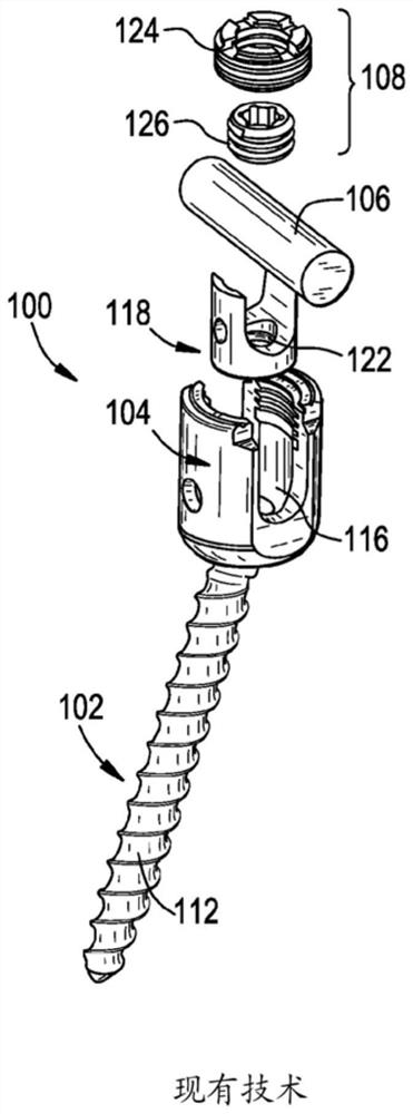 Multi-point angled fixation implant for multiple screws