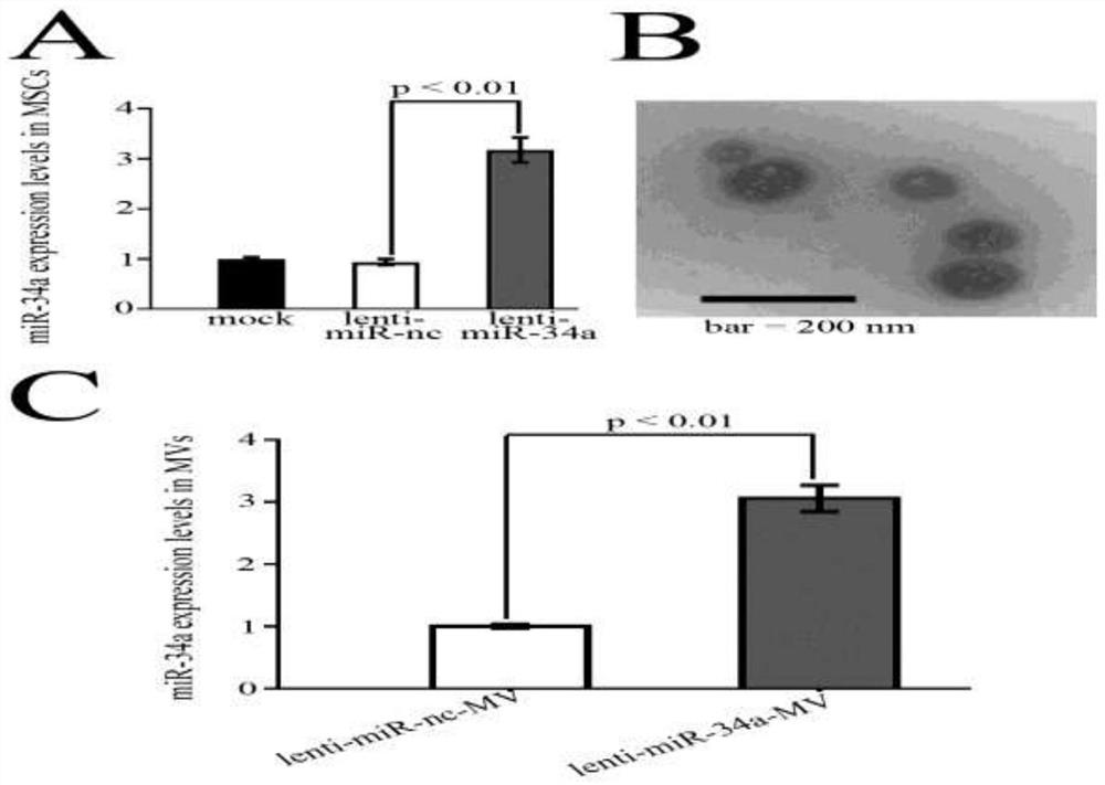 Applications of gene modified mesenchymal stem cell derived microvesicles in preparation of drugs for treating renal injury