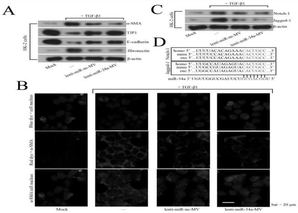 Applications of gene modified mesenchymal stem cell derived microvesicles in preparation of drugs for treating renal injury
