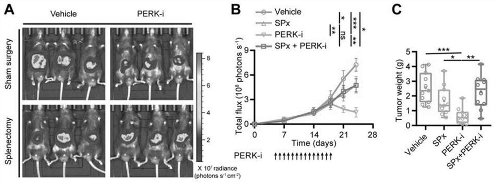 Application of PERK inhibitor to preparation of synergist of liver cancer medicine