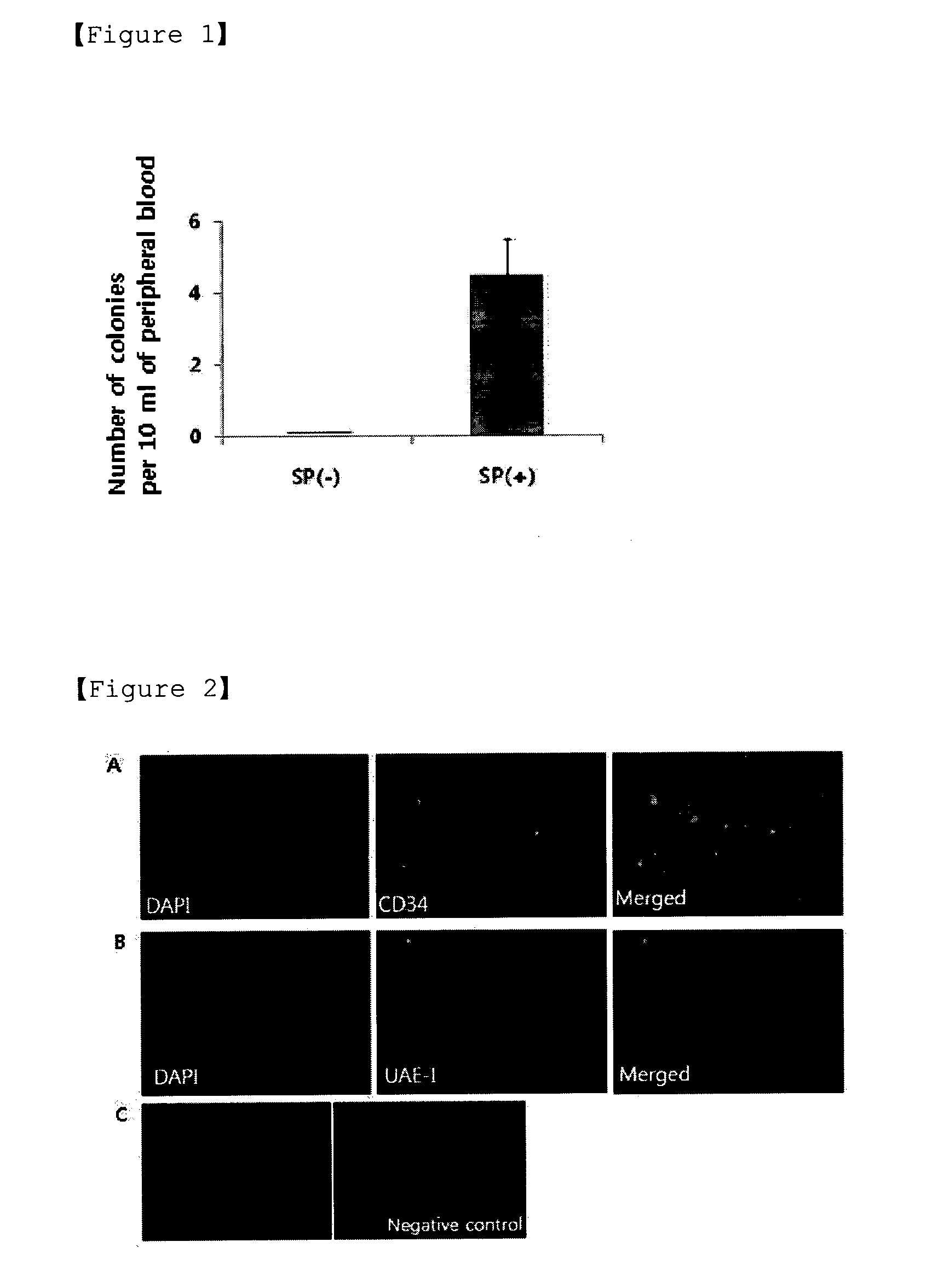 Agent for stimulating mobilization of endothelial progenitor cells