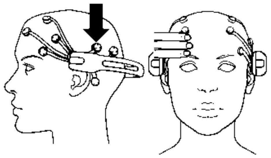 Brain-computer interface rehabilitation training system and method