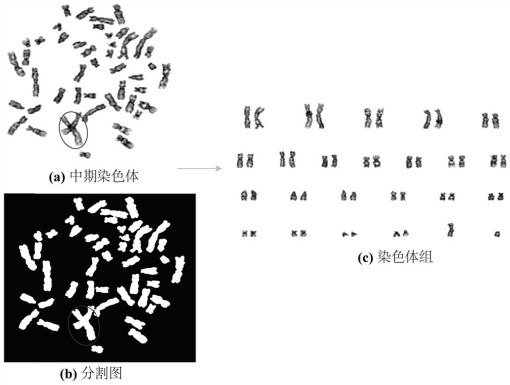 Automatic overlapping chromosome segmentation method based on adversarial learning multi-scale features