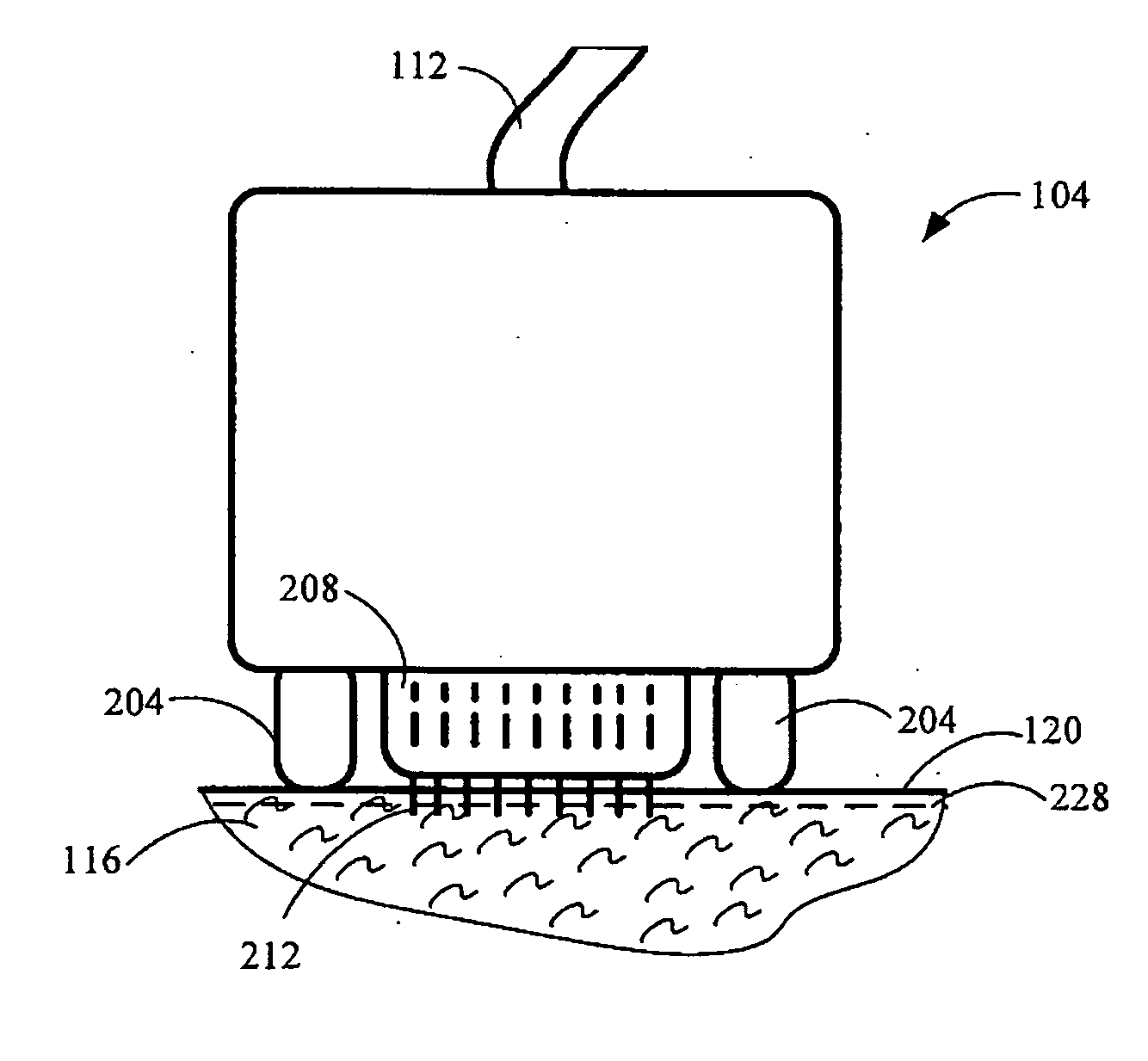 Method and device for collagen growth stimulation