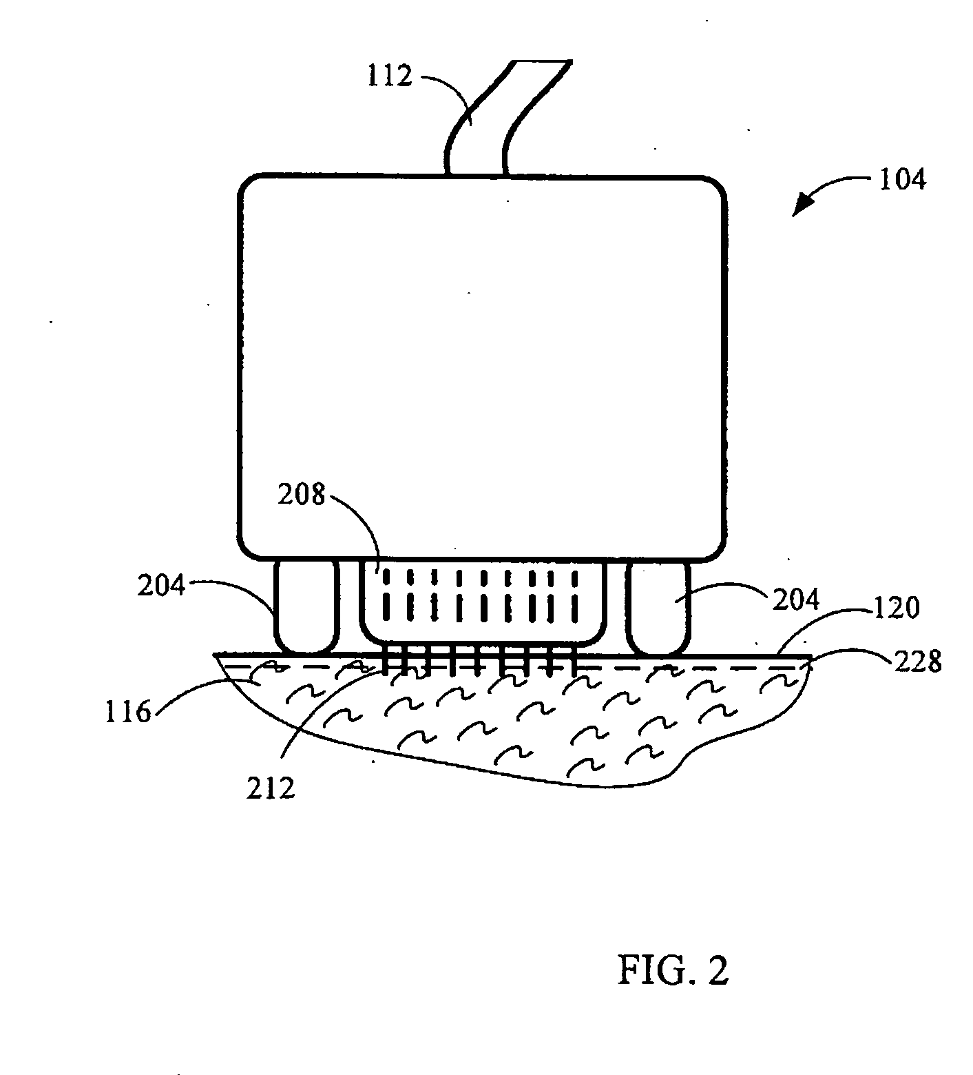 Method and device for collagen growth stimulation