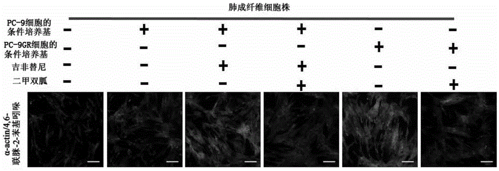 Complex for preventing or weakening pulmonary fibrosis, preparation prepared from complex and application of complex