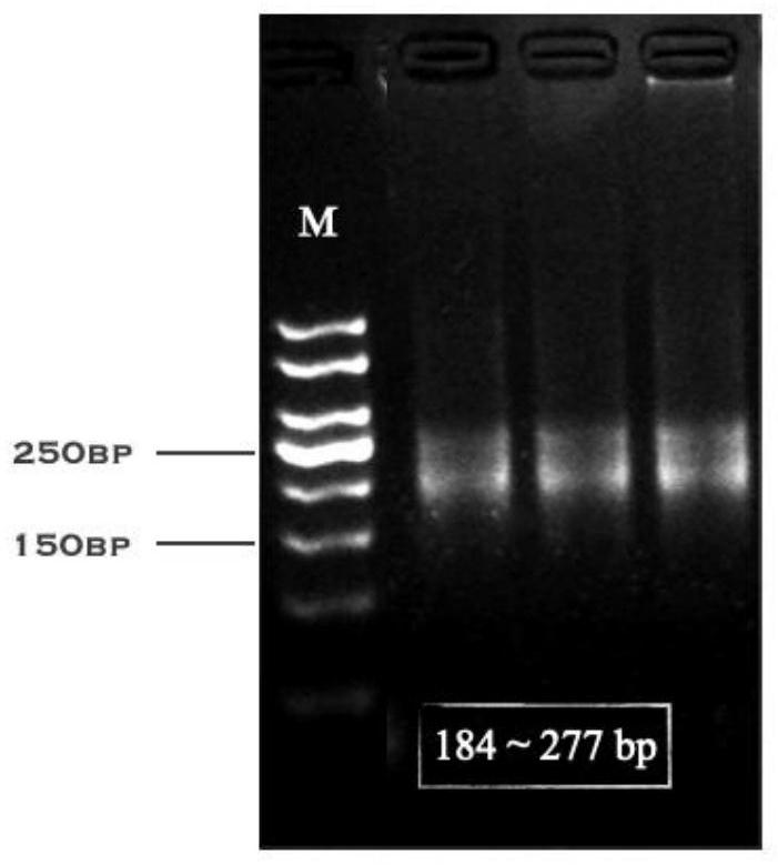 Preparation method for comprehensively amplifying humanTCR beta chain library by adopting few degenerate primers