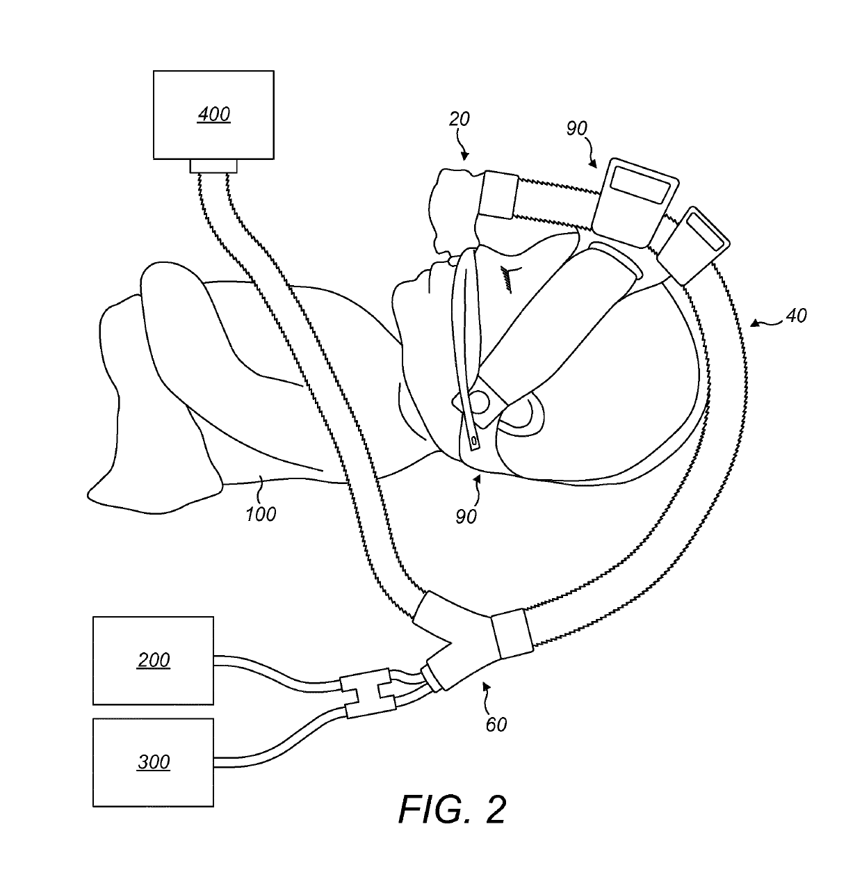 Therapy delivery device