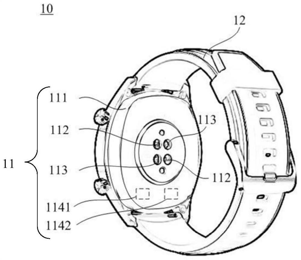 Wearable Devices and Photoelectric Pulse Sensing Components
