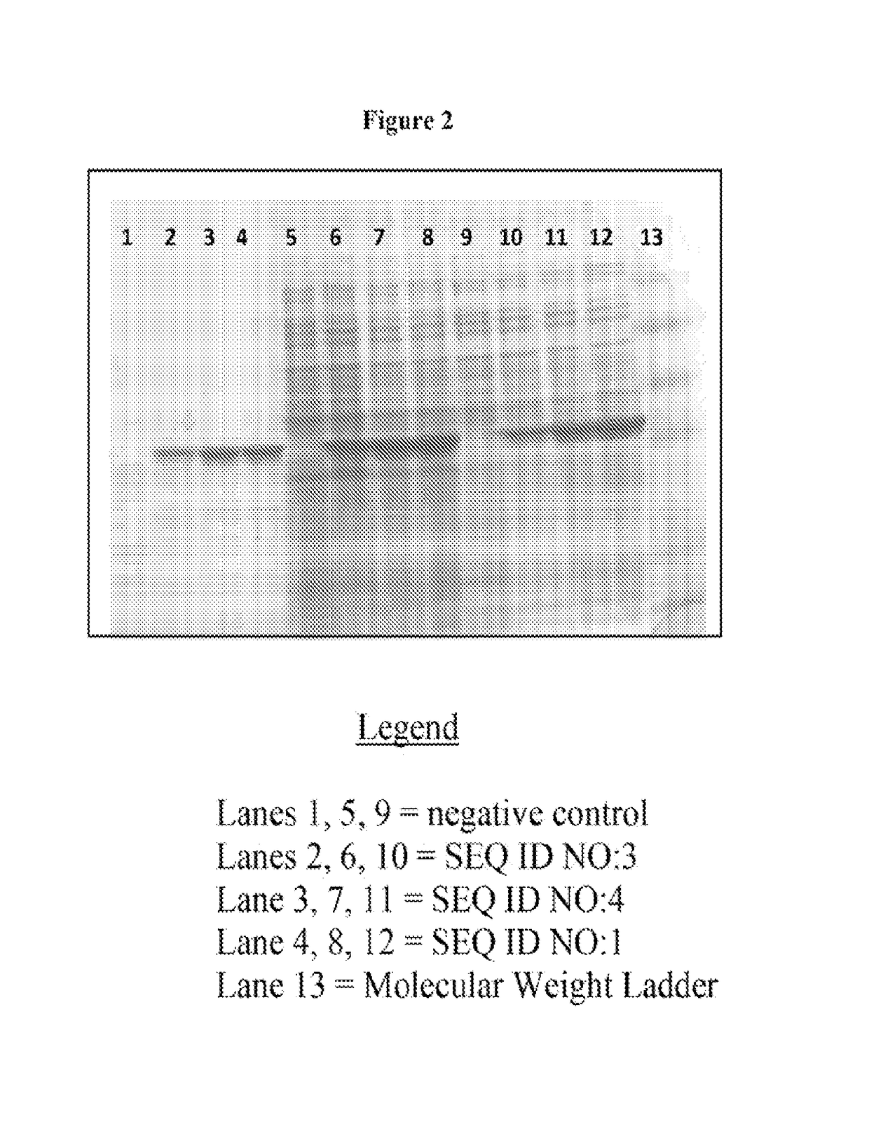 Gene encoding cellulase