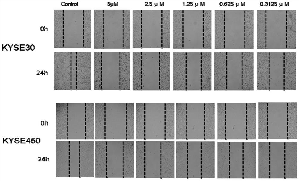 Application of nuclear export protein inhibitor kpt-335 and its composition in antitumor drugs