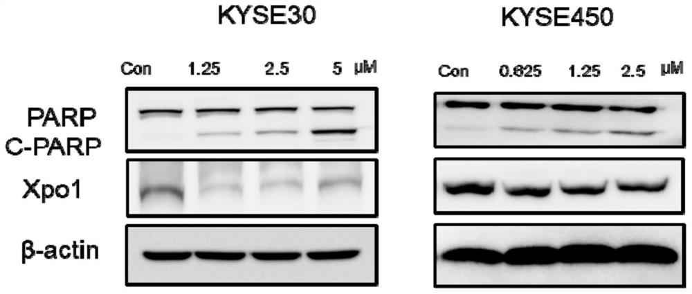 Application of nuclear export protein inhibitor kpt-335 and its composition in antitumor drugs