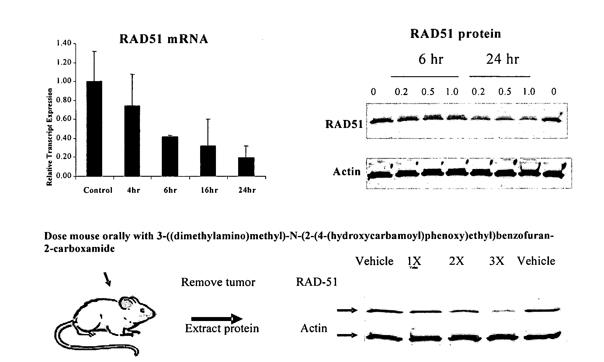Method of using histone deacetylase inhibitors and monitoring biomarkers in combination therapy