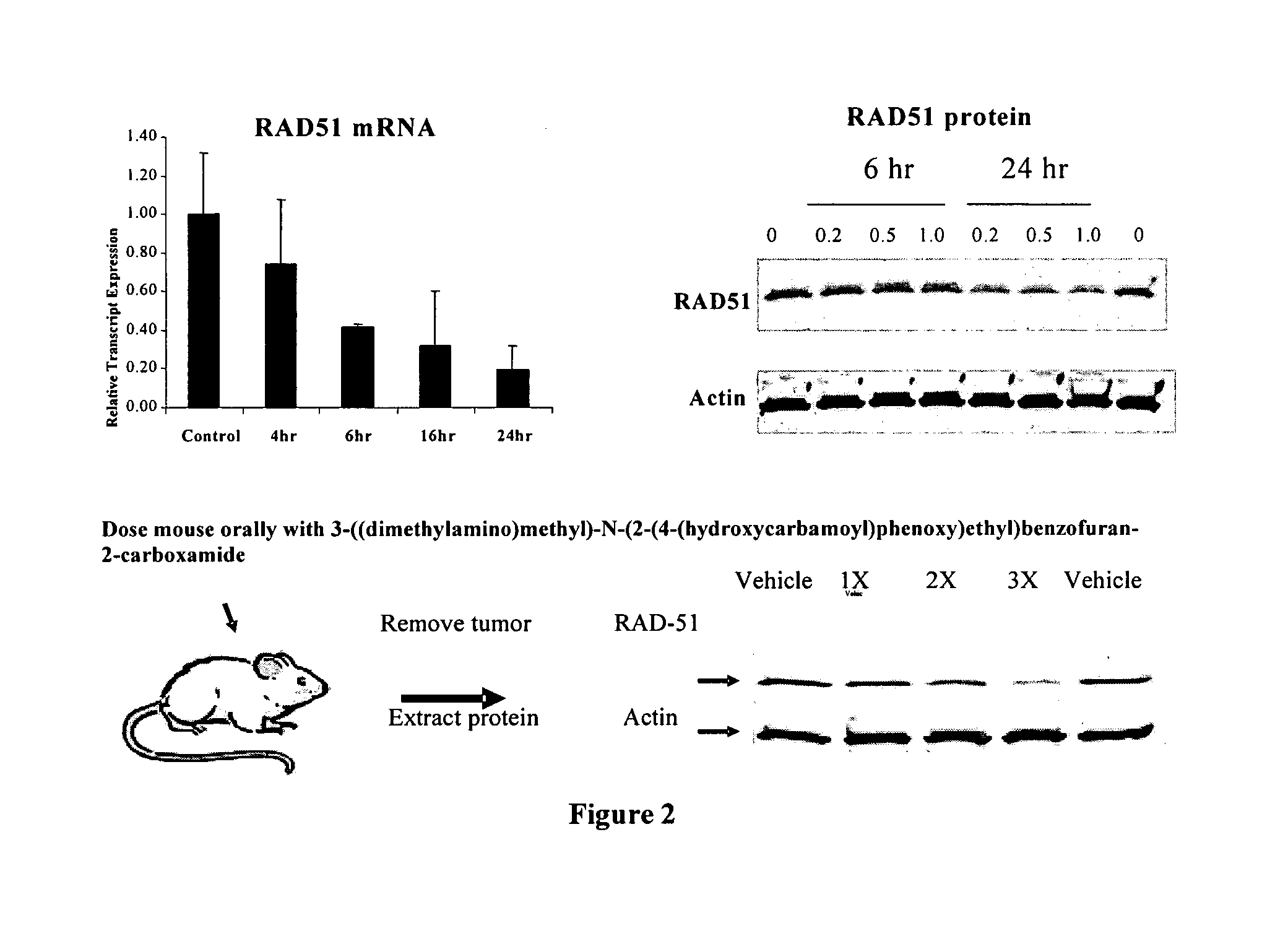 Method of using histone deacetylase inhibitors and monitoring biomarkers in combination therapy