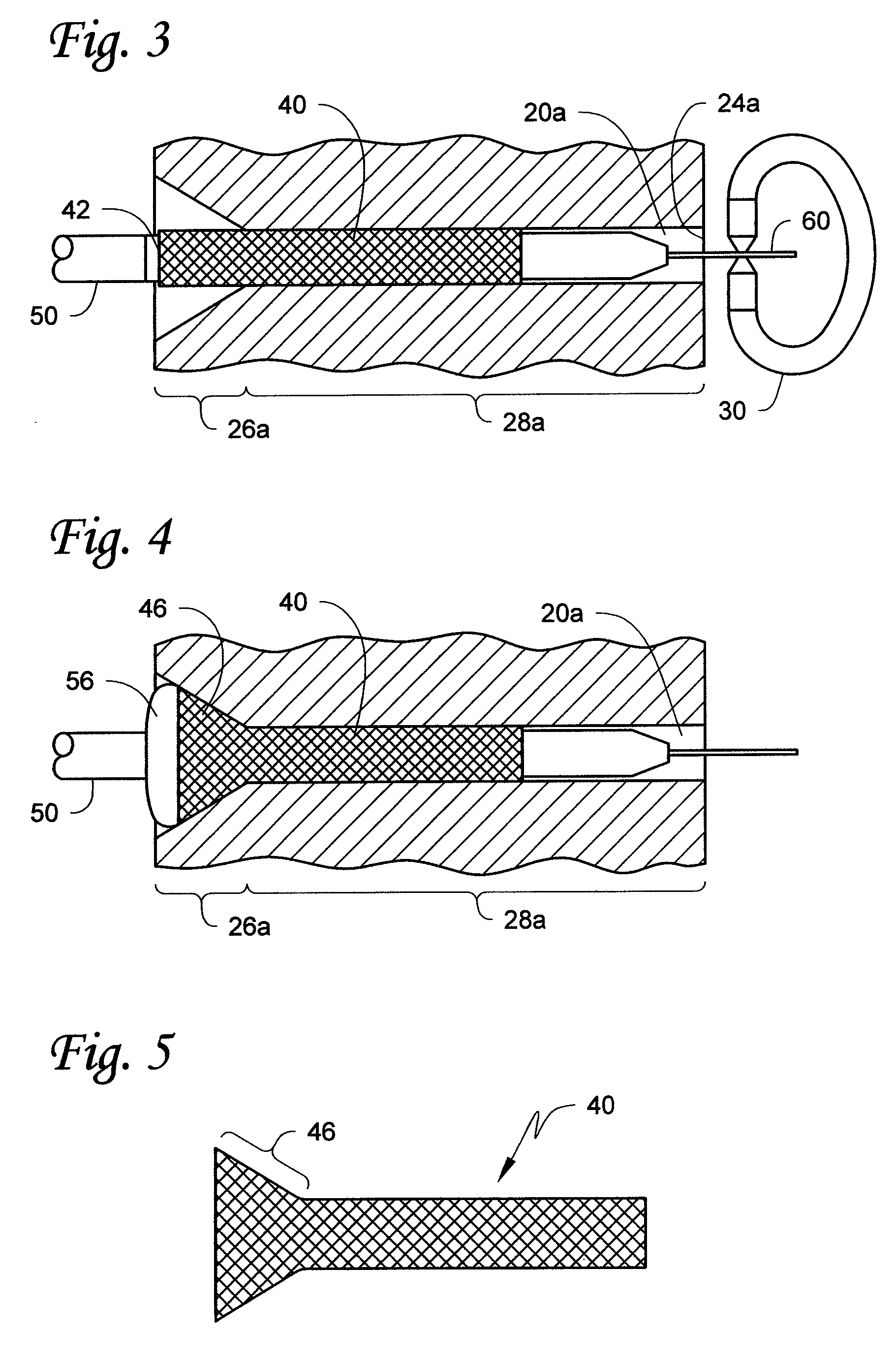 Ostial stent preforming apparatus, kits and methods